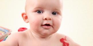 Пигментные пятна на теле у ребенка причины и лечение